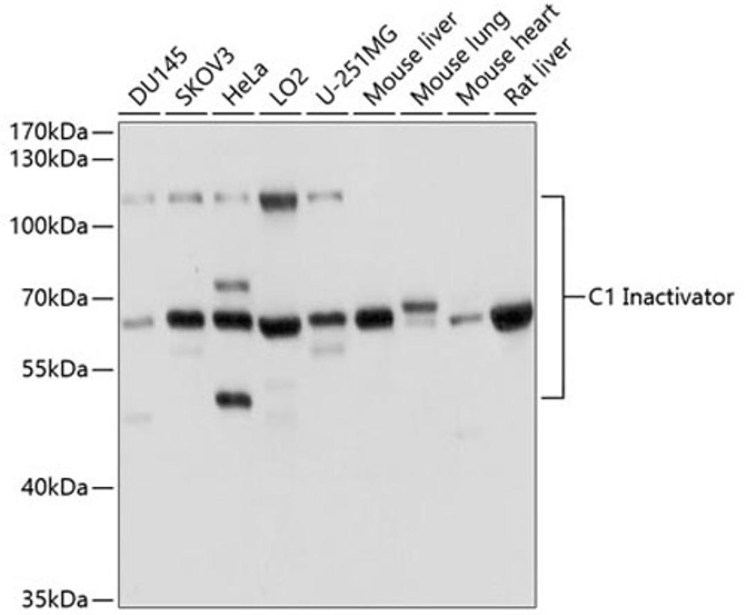 Western blot - C1 Inactivator antibody (A1717)