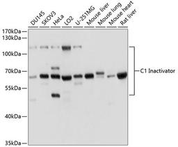 Western blot - C1 Inactivator antibody (A1717)