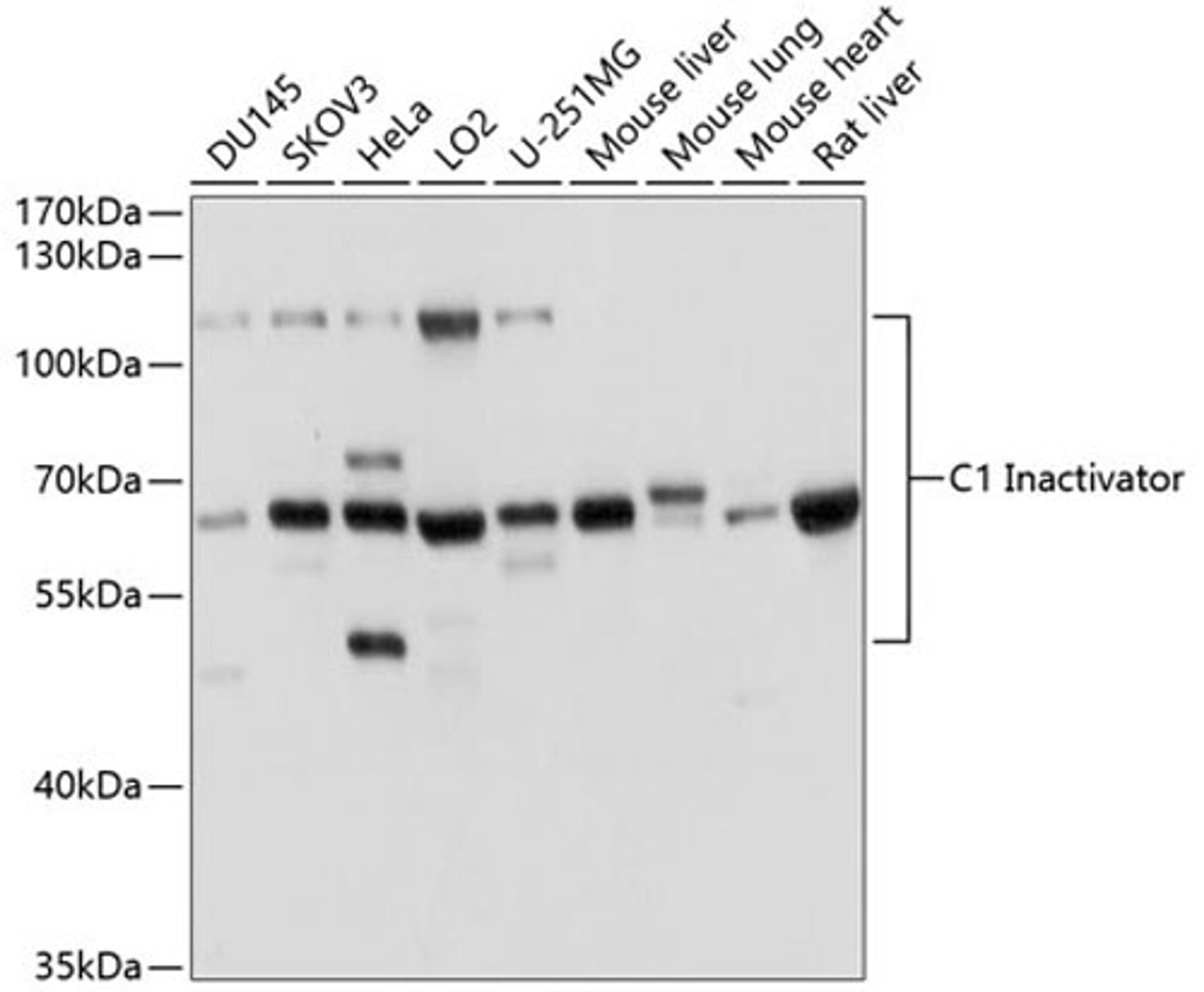 Western blot - C1 Inactivator antibody (A1717)