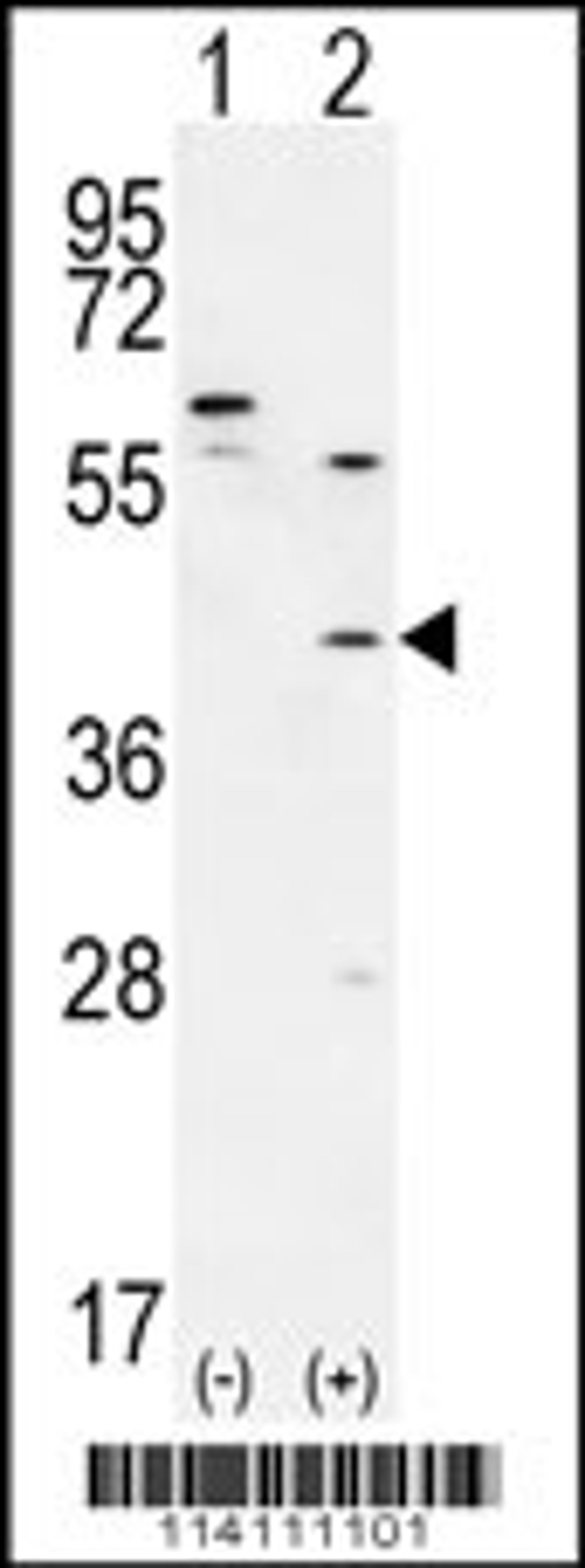 Western blot analysis of TGIF1 using rabbit polyclonal using 293 cell lysates (2 ug/lane) either nontransfected (Lane 1) or transiently transfected (Lane 2) with the TGIF1 gene.