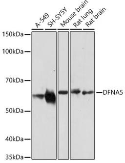 Western blot - DFNA5/GSDME antibody (A7432)