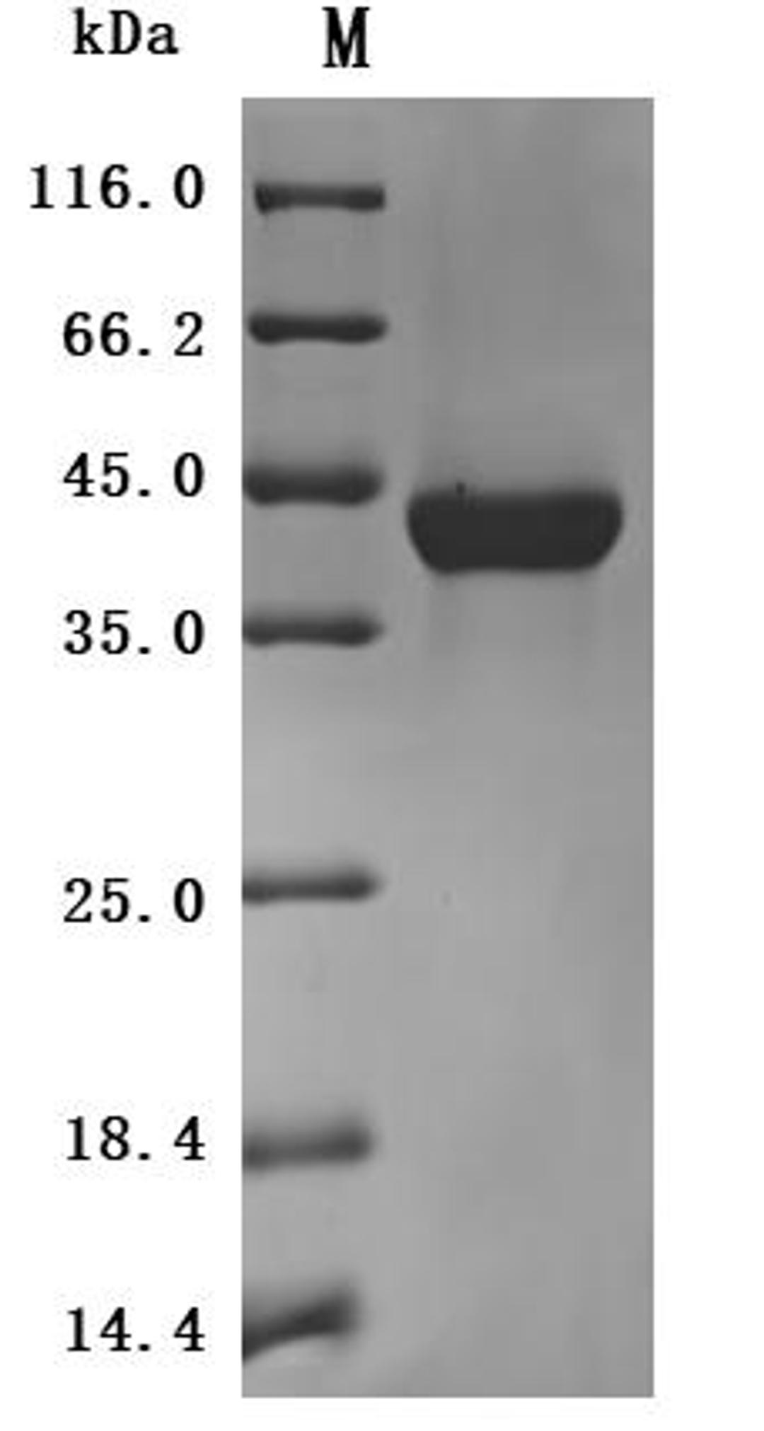 (Tris-Glycine gel) Discontinuous SDS-PAGE (reduced) with 5% enrichment gel and 15% separation gel.