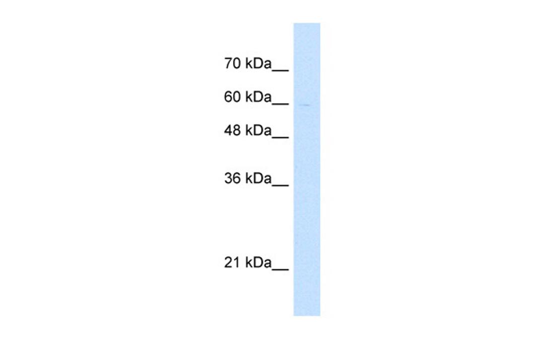 Antibody used in WB on Human Jurkat cells at 5.0 ug/ml.