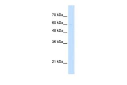 Antibody used in WB on Human Jurkat cells at 5.0 ug/ml.