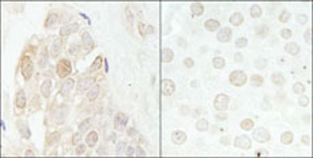 Detection of human and mouse CDK2 by immunohistochemistry.