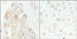 Detection of human and mouse CDK2 by immunohistochemistry.