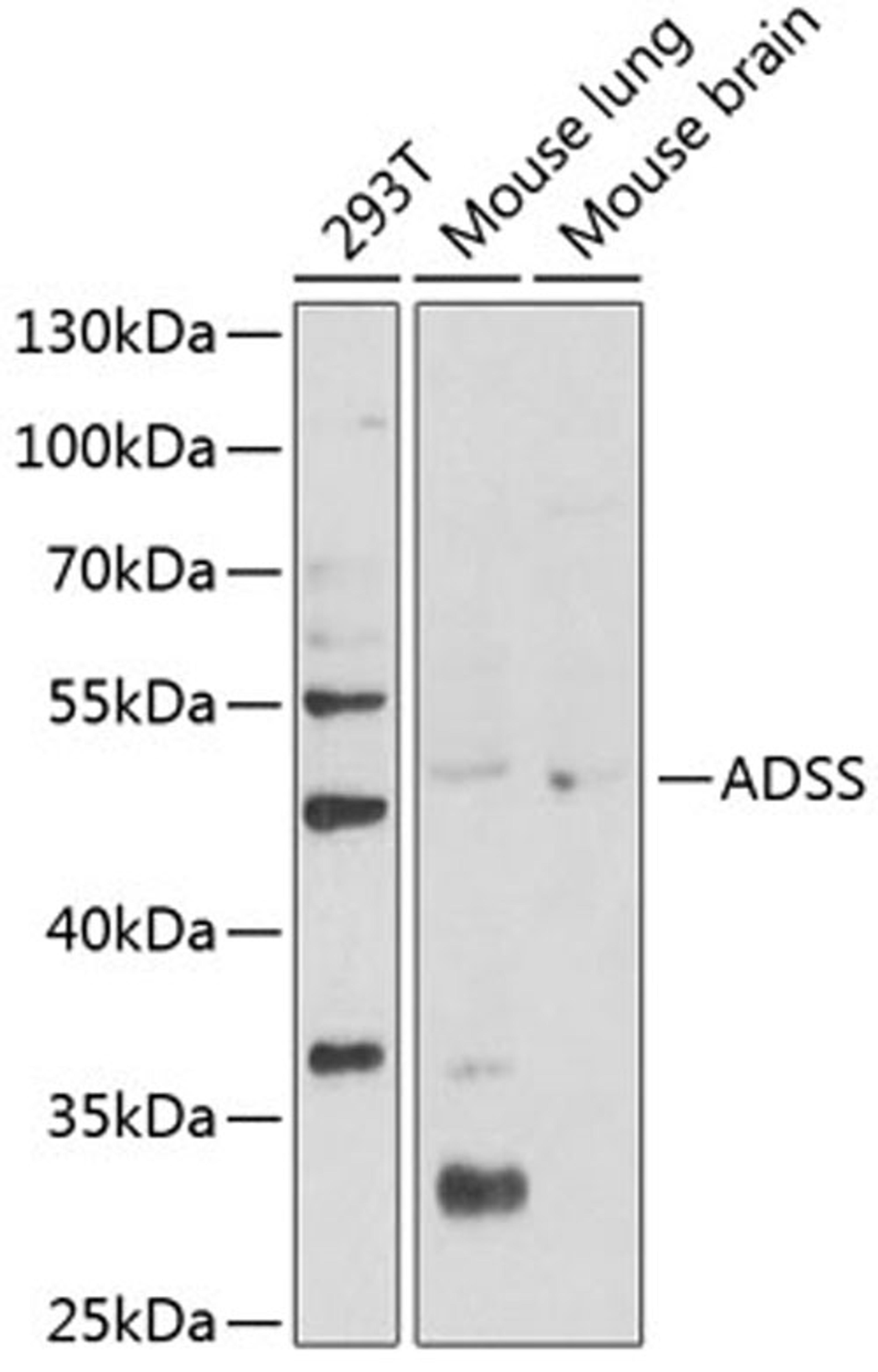 Western blot - ADSS Antibody (A12398)