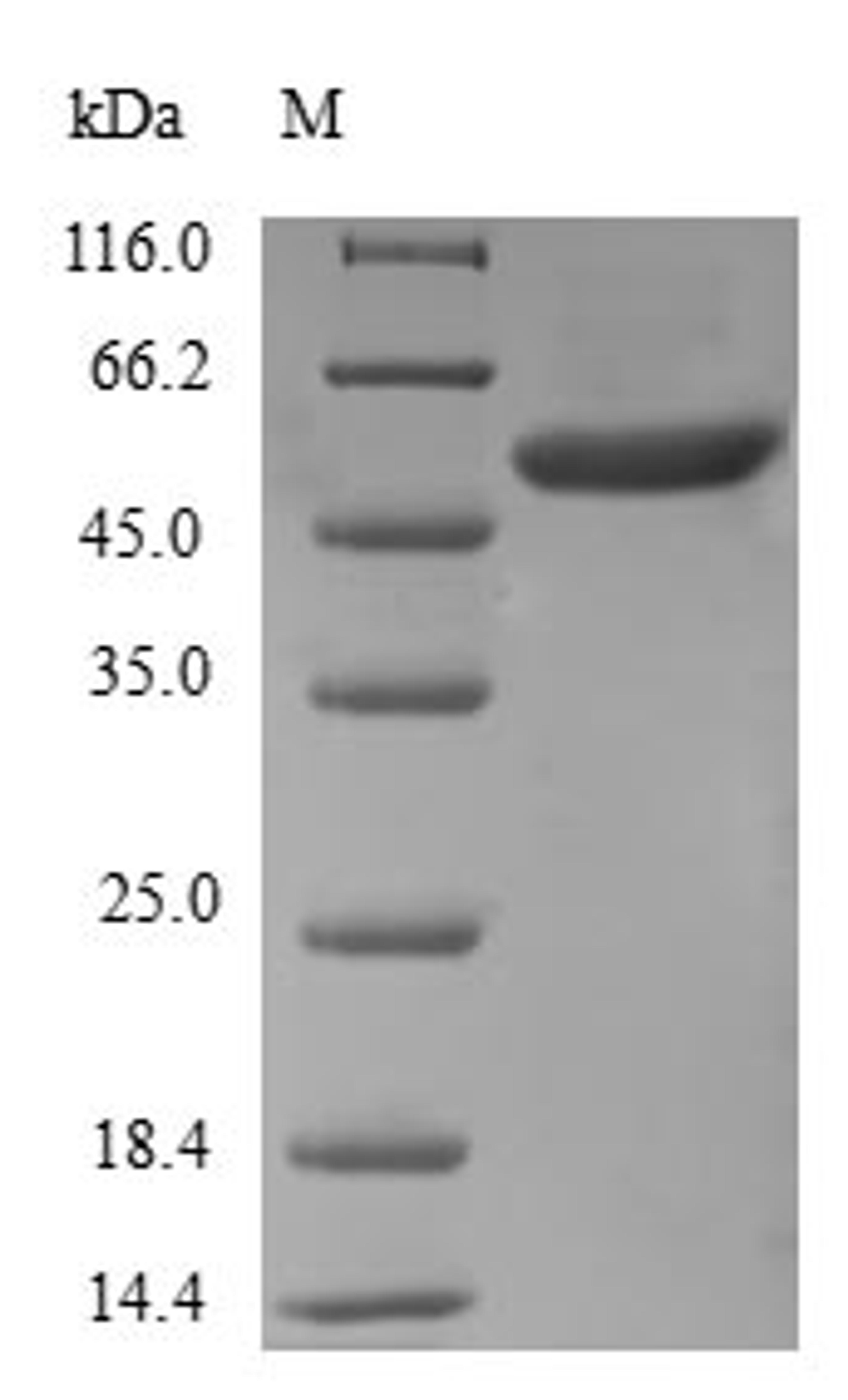(Tris-Glycine gel) Discontinuous SDS-PAGE (reduced) with 5% enrichment gel and 15% separation gel.