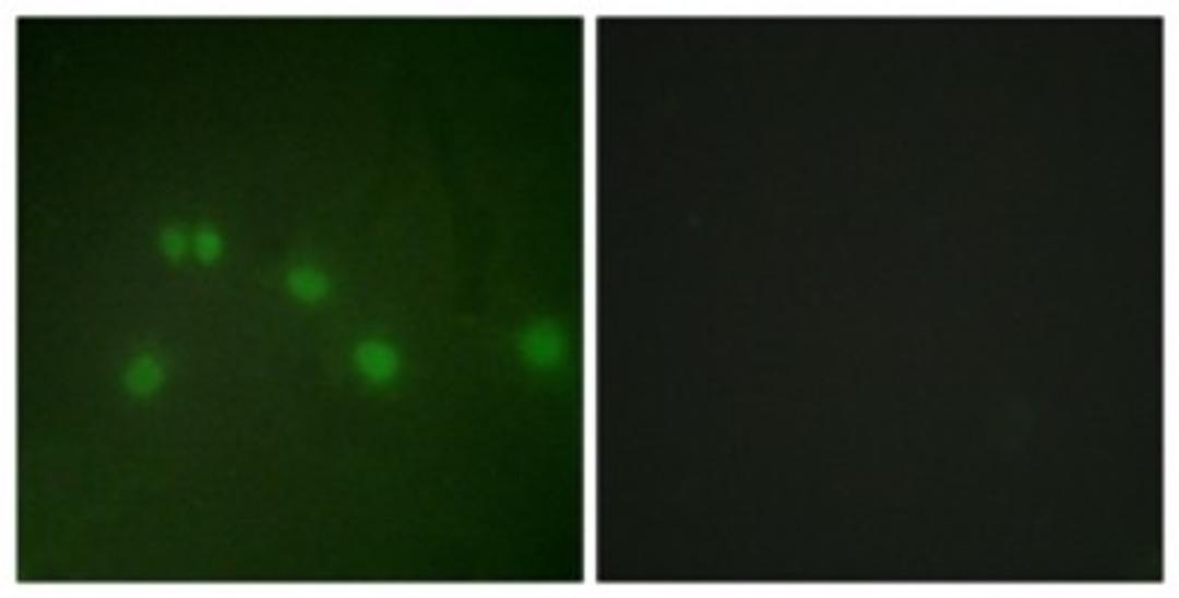 Immunocytochemistry/Immunofluorescence: NR2F2 Antibody [NBP1-67885] - Analysis of HuvEc cells, using NR2F2 Antibody. The picture on the right is treated with the synthesized peptide.