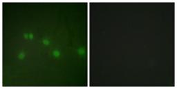 Immunocytochemistry/Immunofluorescence: NR2F2 Antibody [NBP1-67885] - Analysis of HuvEc cells, using NR2F2 Antibody. The picture on the right is treated with the synthesized peptide.