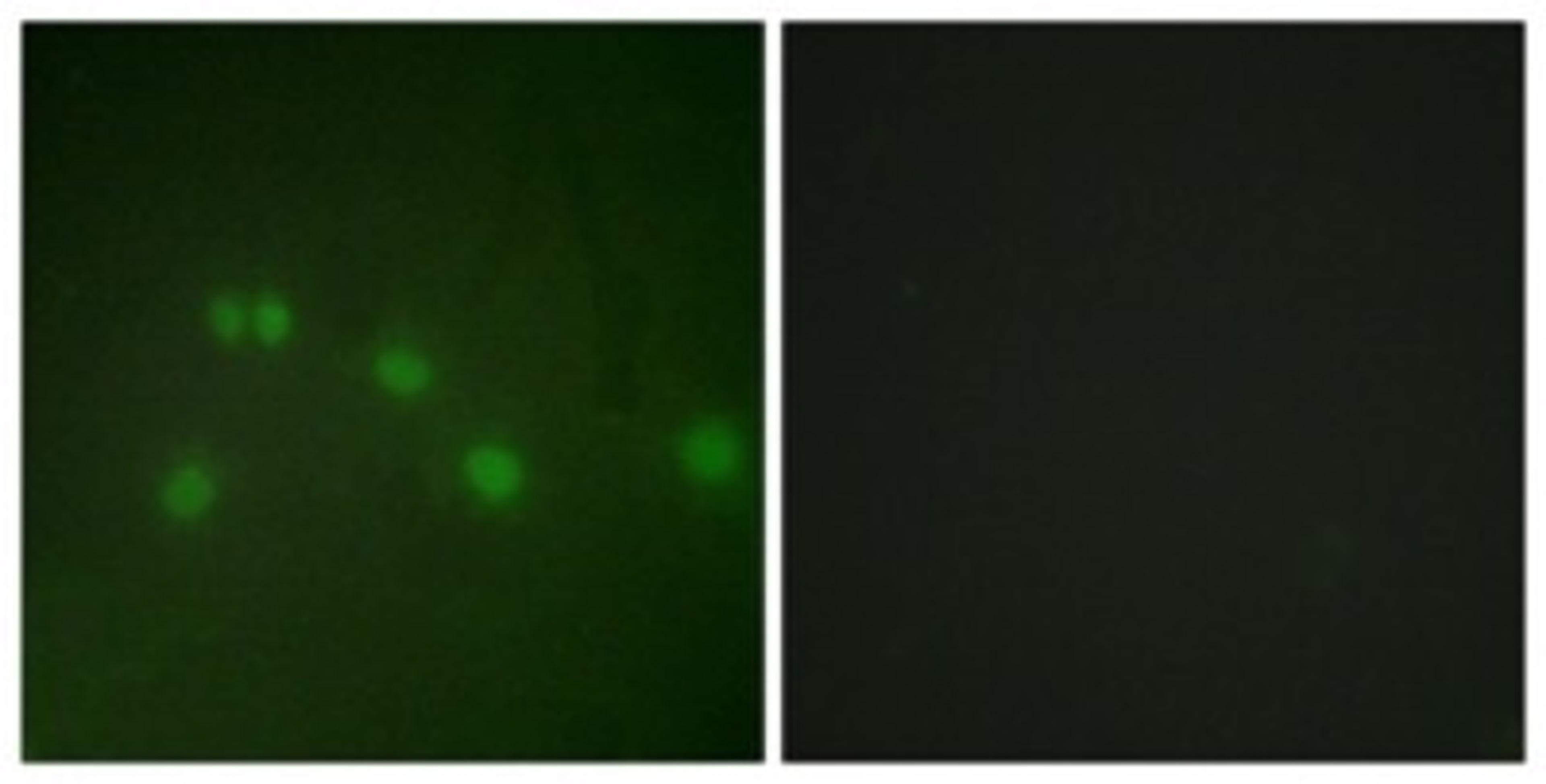 Immunocytochemistry/Immunofluorescence: NR2F2 Antibody [NBP1-67885] - Analysis of HuvEc cells, using NR2F2 Antibody. The picture on the right is treated with the synthesized peptide.