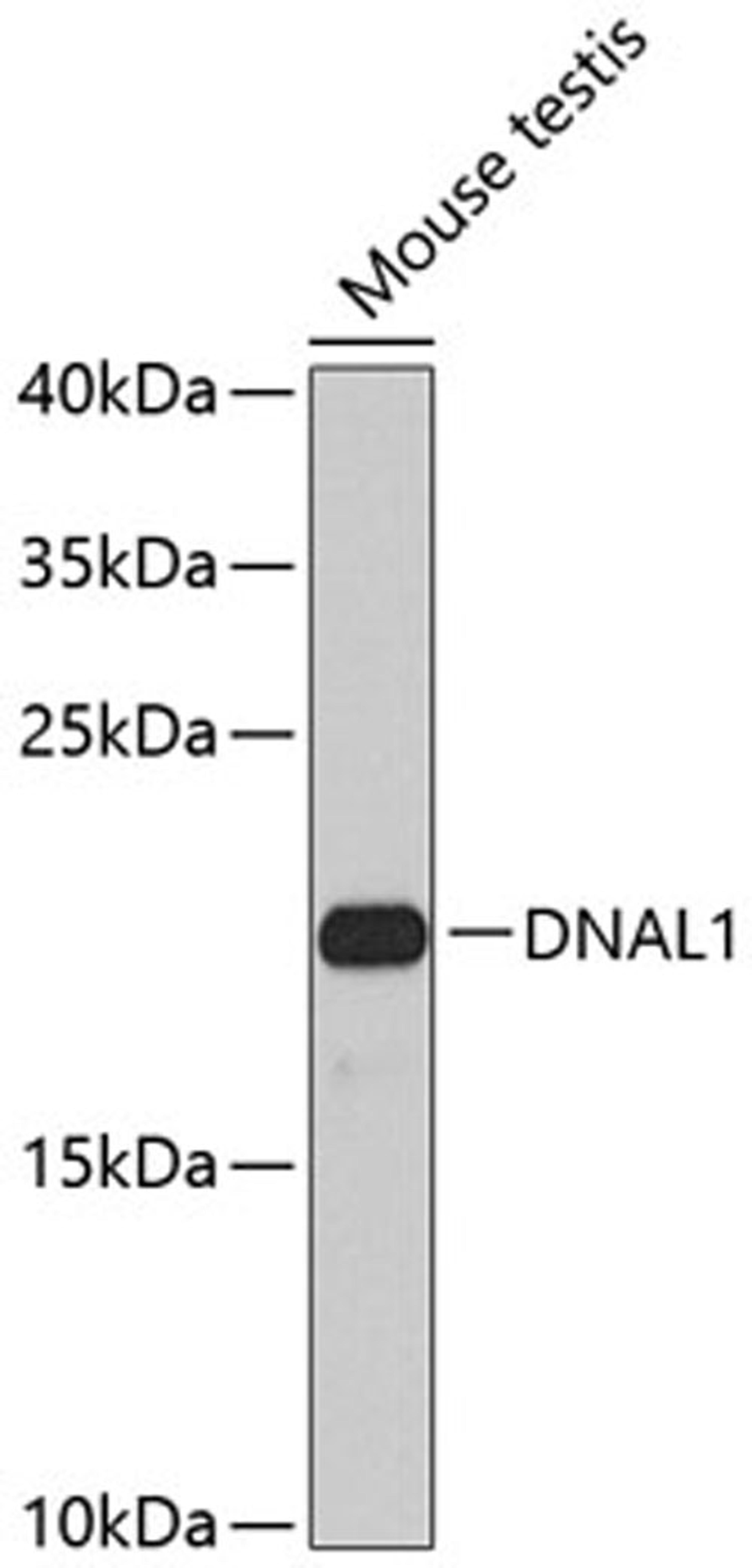 Western blot - DNAL1 antibody (A8267)