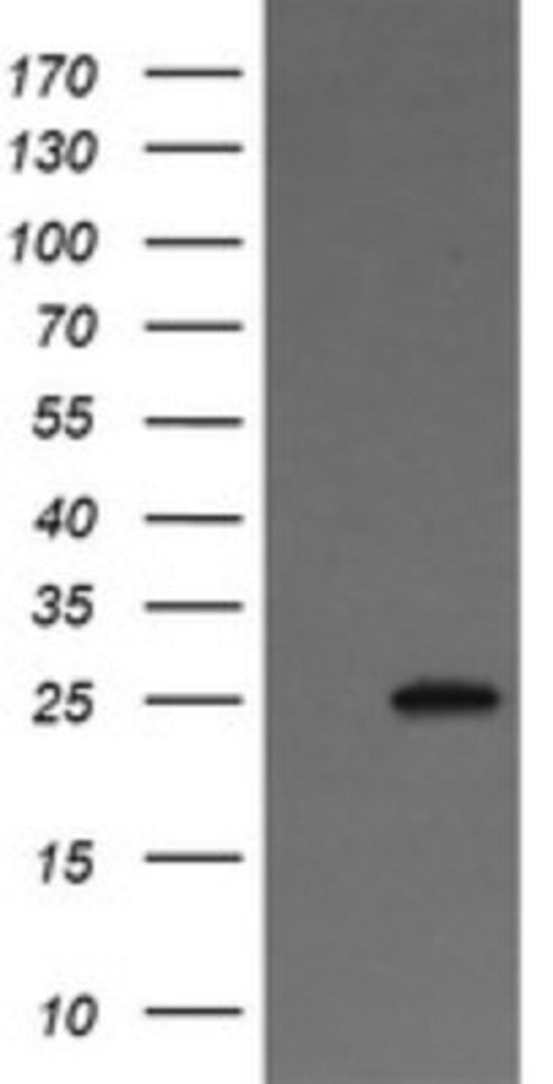 Western Blot: VTI1A Antibody (1F4) [NBP2-45413] - Analysis of HEK293T cells were transfected with the pCMV6-ENTRY control (Left lane) or pCMV6-ENTRY VTI1A.