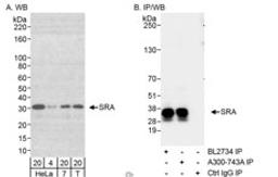 Detection of human SRA by western blot and immunoprecipitation.