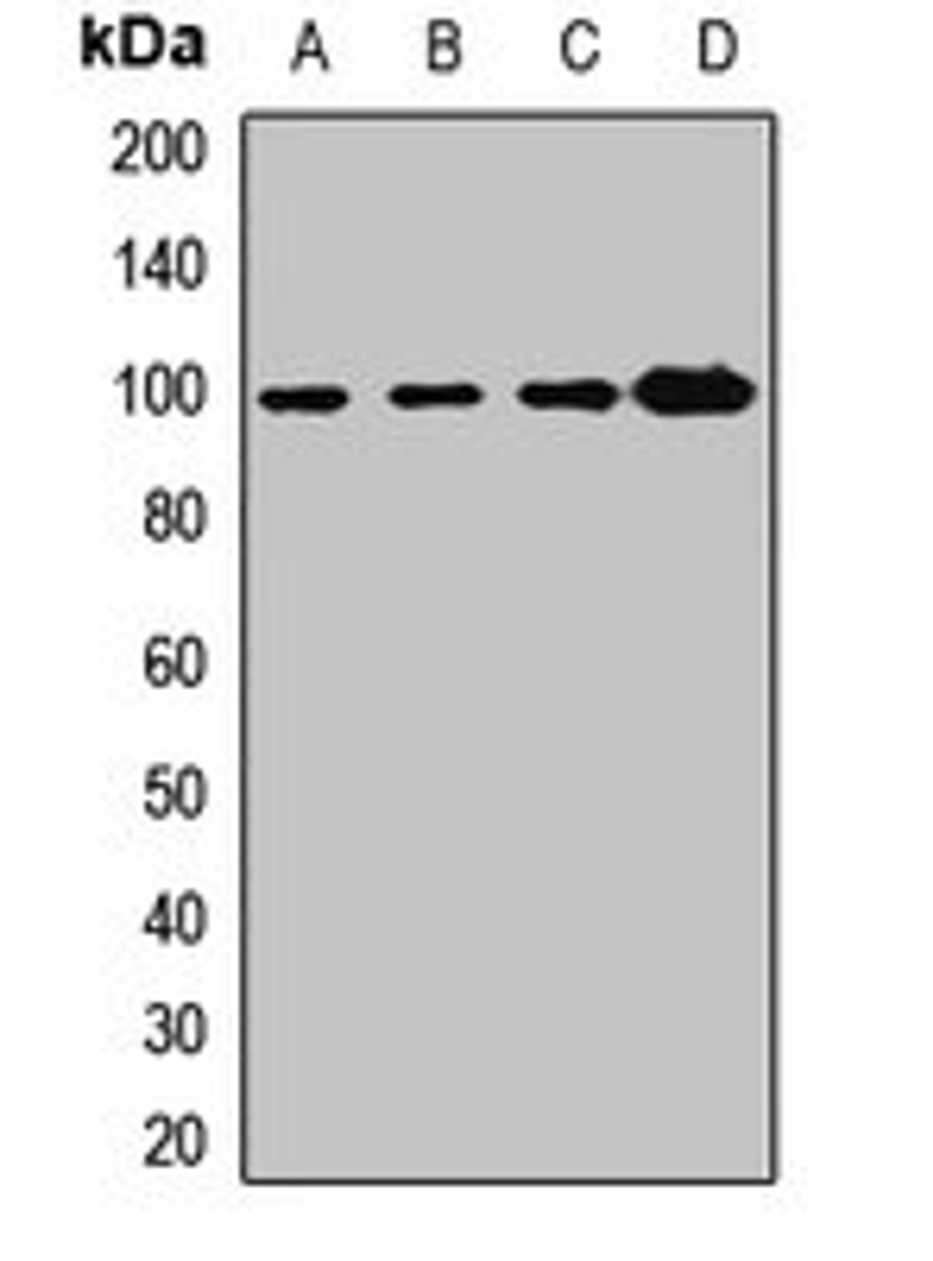 Western blot analysis of HepG2 (Lane1), mouse liver (Lane2), mouse kidney (Lane3), rat kidney (Lane4) whole cell lysates using COPG1 antibody