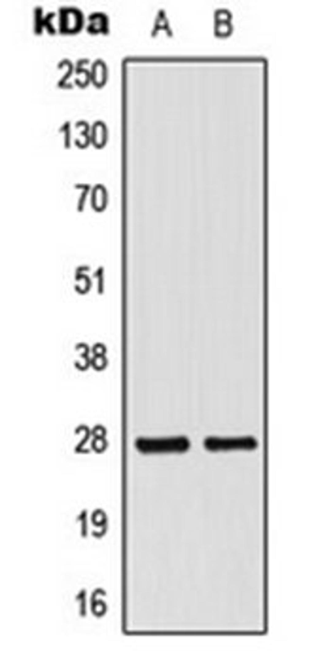 Western blot analysis of HepG2 (Lane 1), HeLa (Lane 2) whole cell lysates using MRPL16 antibody