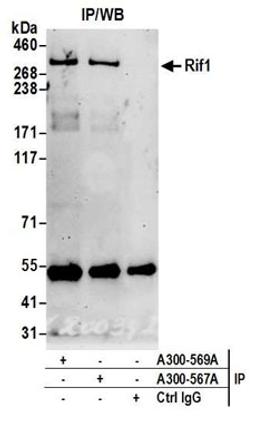 Detection of human Rif1 by western blot of immunoprecipitates.