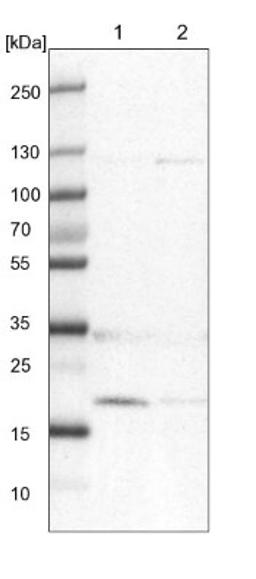 Western Blot: D4S234E Antibody [NBP1-87425] - Lane 1: NIH-3T3 cell lysate (Mouse embryonic fibroblast cells)<br/>Lane 2: NBT-II cell lysate (Rat Wistar bladder tumour cells)