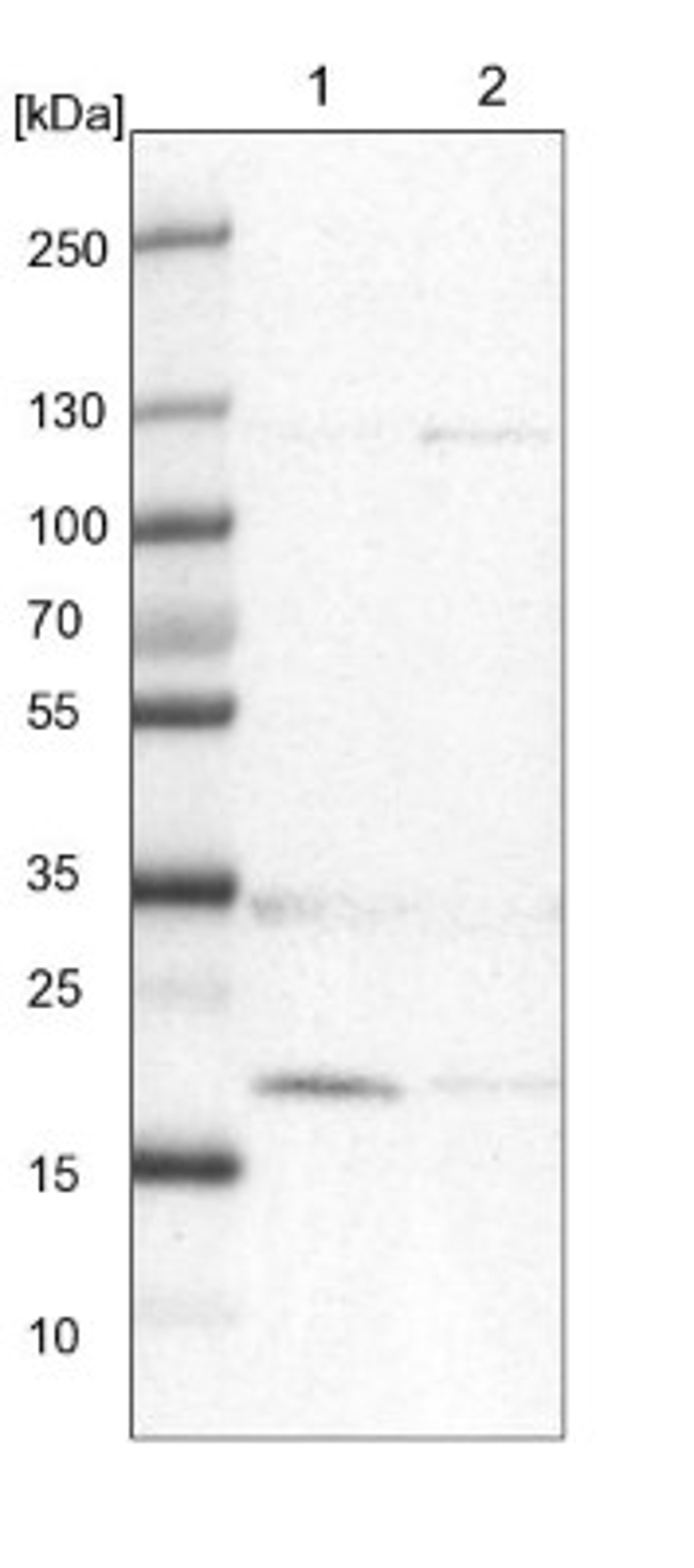 Western Blot: D4S234E Antibody [NBP1-87425] - Lane 1: NIH-3T3 cell lysate (Mouse embryonic fibroblast cells)<br/>Lane 2: NBT-II cell lysate (Rat Wistar bladder tumour cells)