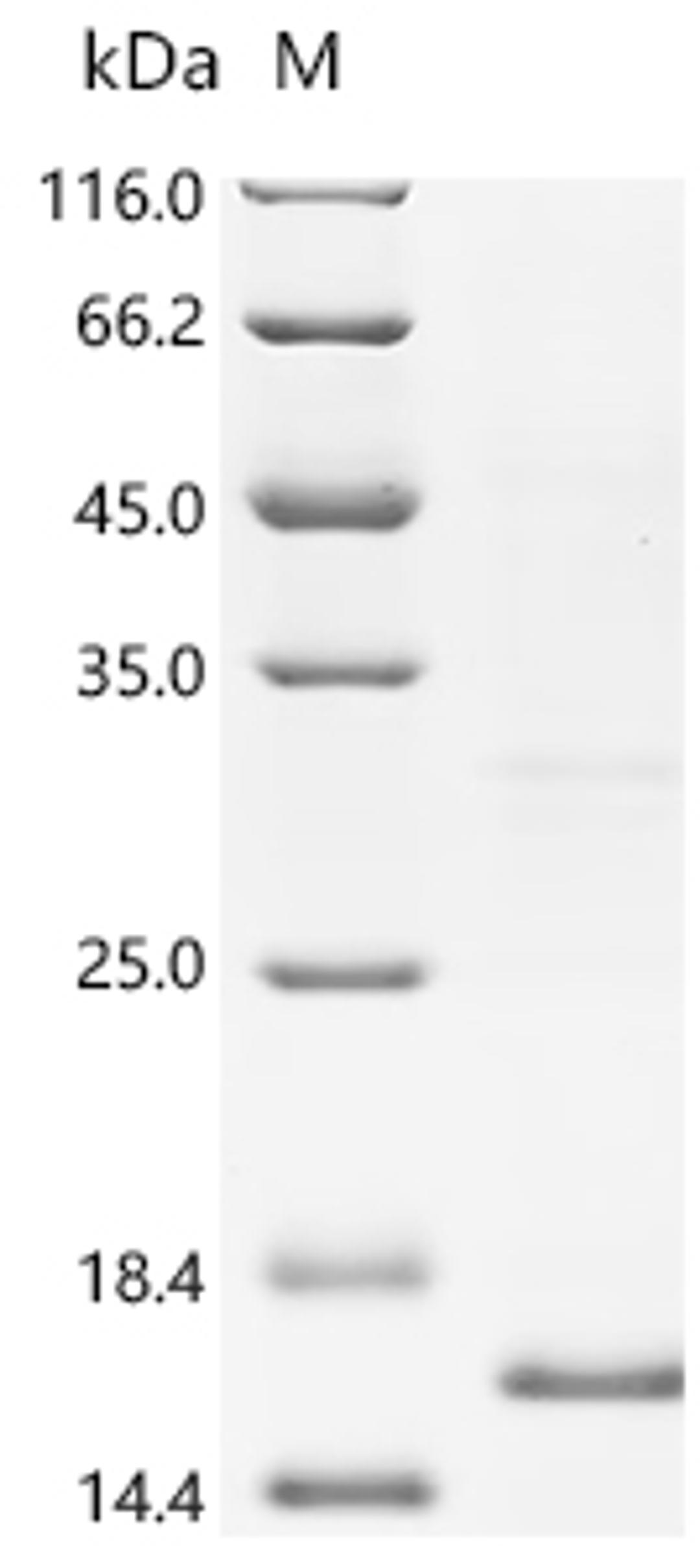 (Tris-Glycine gel) Discontinuous SDS-PAGE (reduced) with 5% enrichment gel and 15% separation gel.