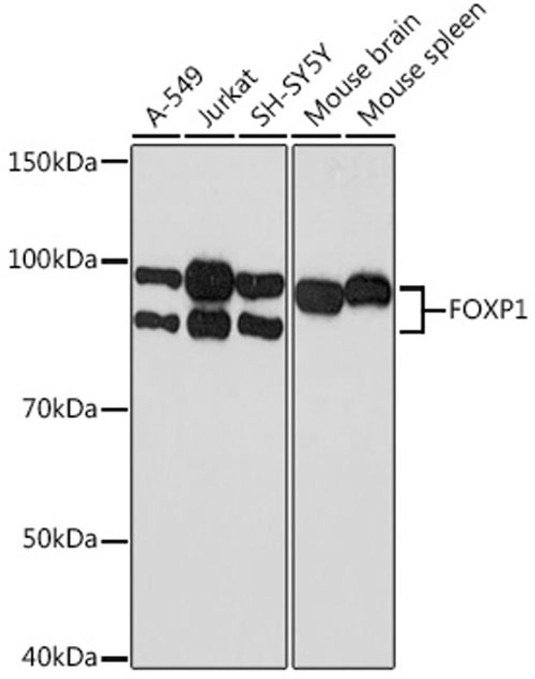 Western blot - FOXP1 Rabbit mAb (A9540)