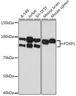 Western blot - FOXP1 Rabbit mAb (A9540)