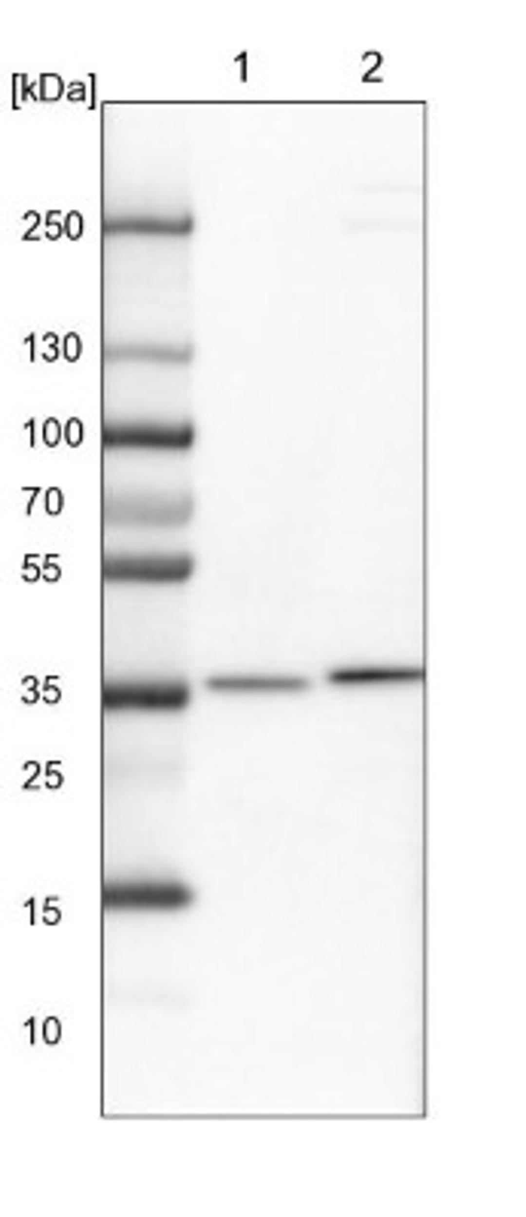 Western Blot: RNF146 Antibody [NBP1-85318] - Lane 1: NIH-3T3 cell lysate (Mouse embryonic fibroblast cells)<br/>Lane 2: NBT-II cell lysate (Rat Wistar bladder tumour cells)