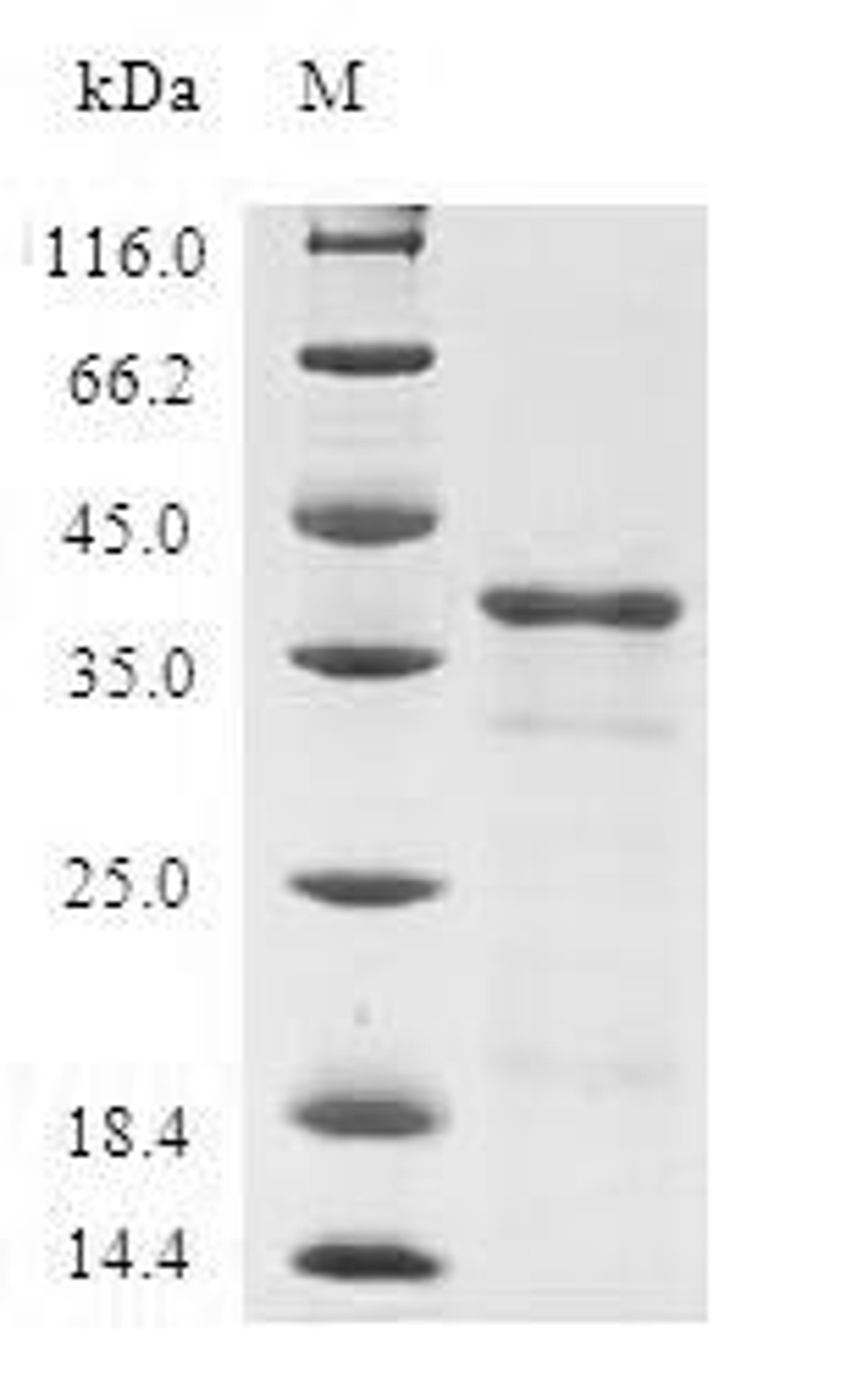 (Tris-Glycine gel) Discontinuous SDS-PAGE (reduced) with 5% enrichment gel and 15% separation gel.