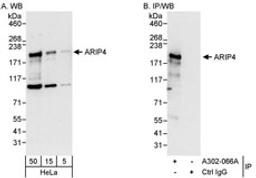 Detection of human ARIP4 by western blot and immunoprecipitation.