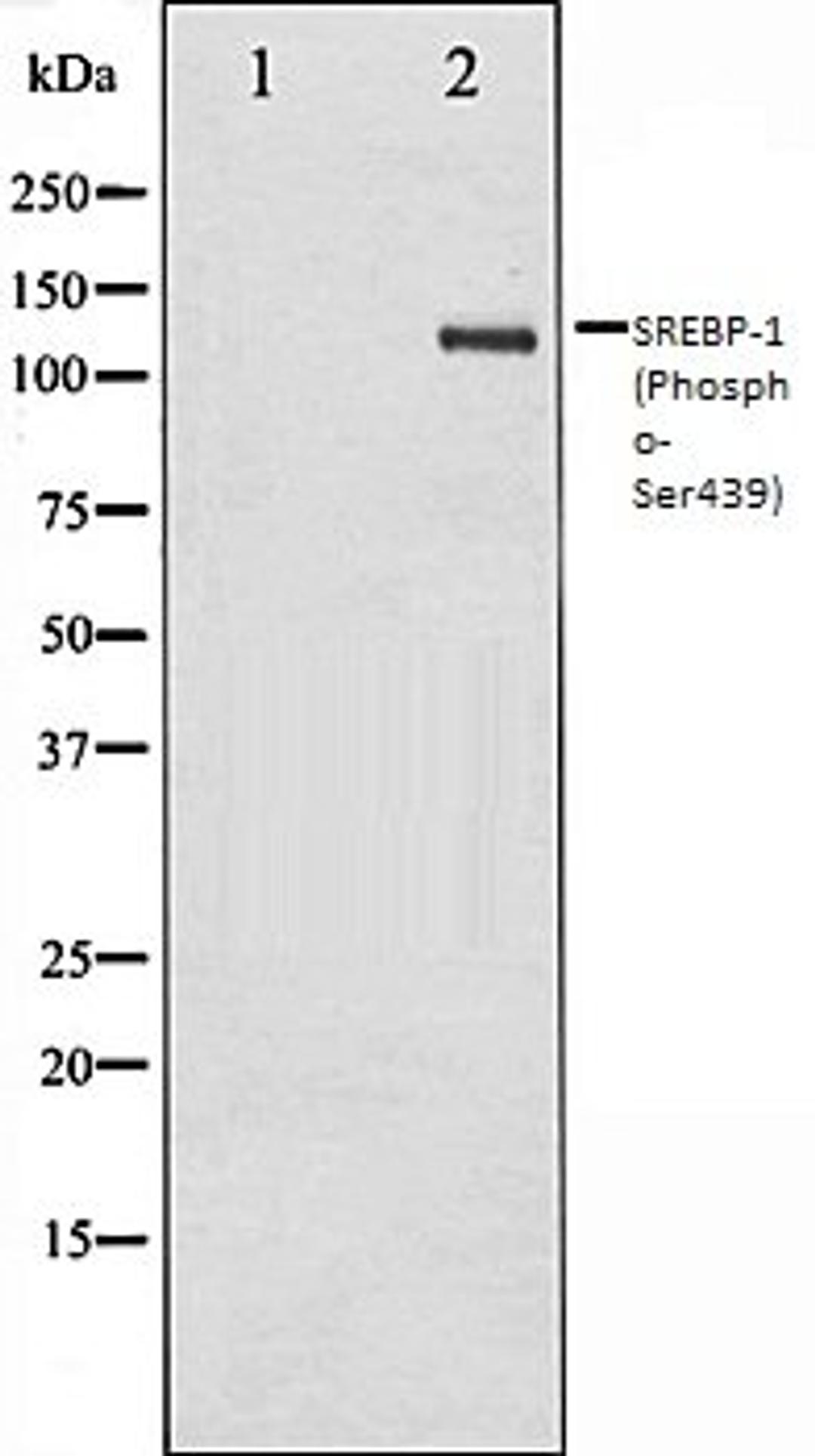 Western blot analysis of Jurkat whole cell lysates using SREBP-1 (Phospho-Ser439) antibody, The lane on the left is treated with the antigen-specific peptide.