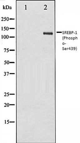 Western blot analysis of Jurkat whole cell lysates using SREBP-1 (Phospho-Ser439) antibody, The lane on the left is treated with the antigen-specific peptide.