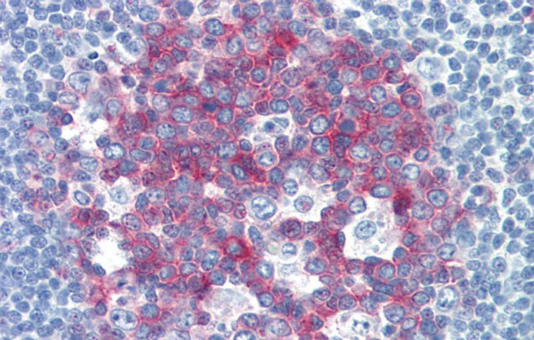 Antibody used in IHC on Human Tonsil at 5.0 ug/ml.