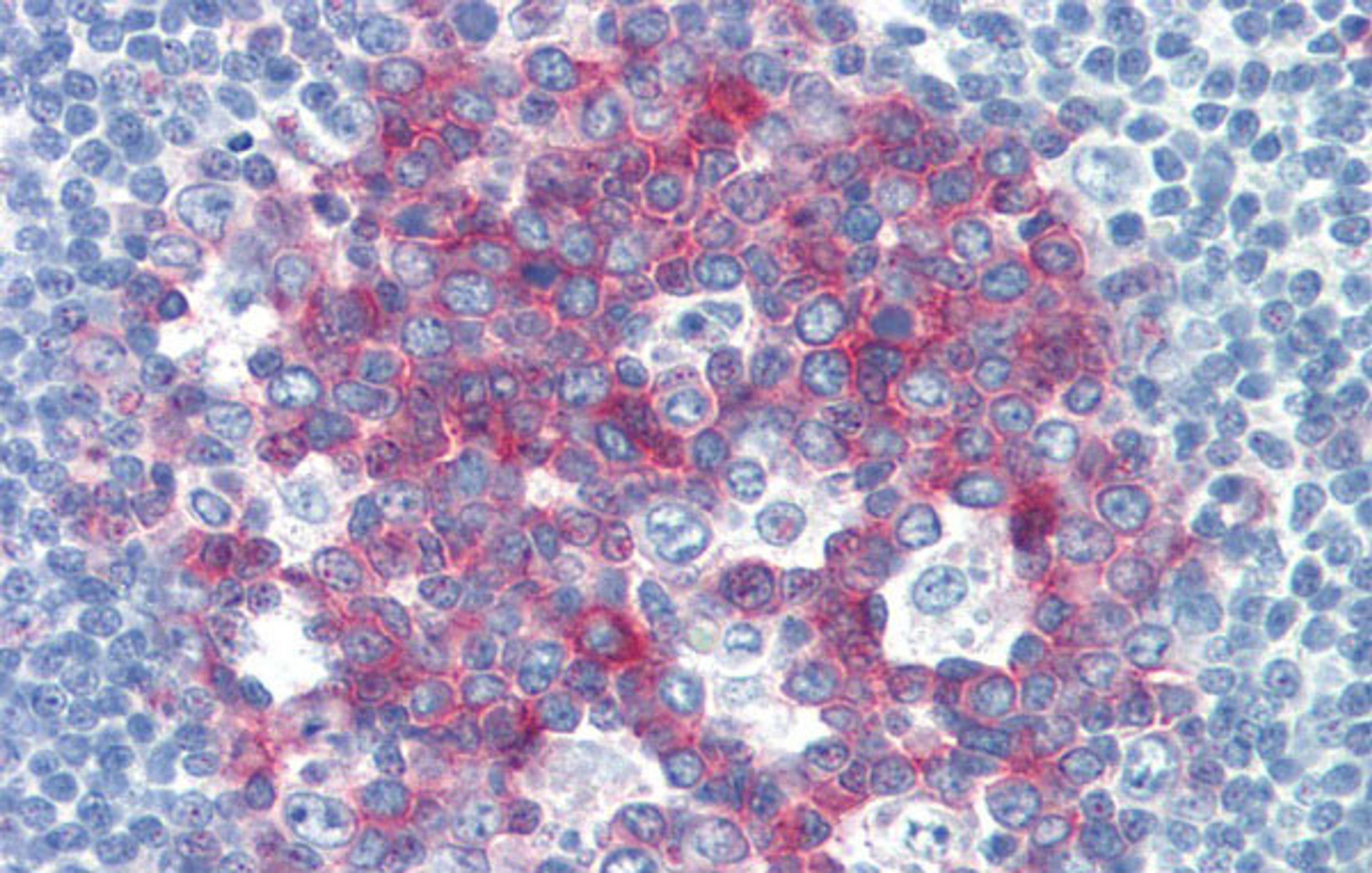 Antibody used in IHC on Human Tonsil at 5.0 ug/ml.