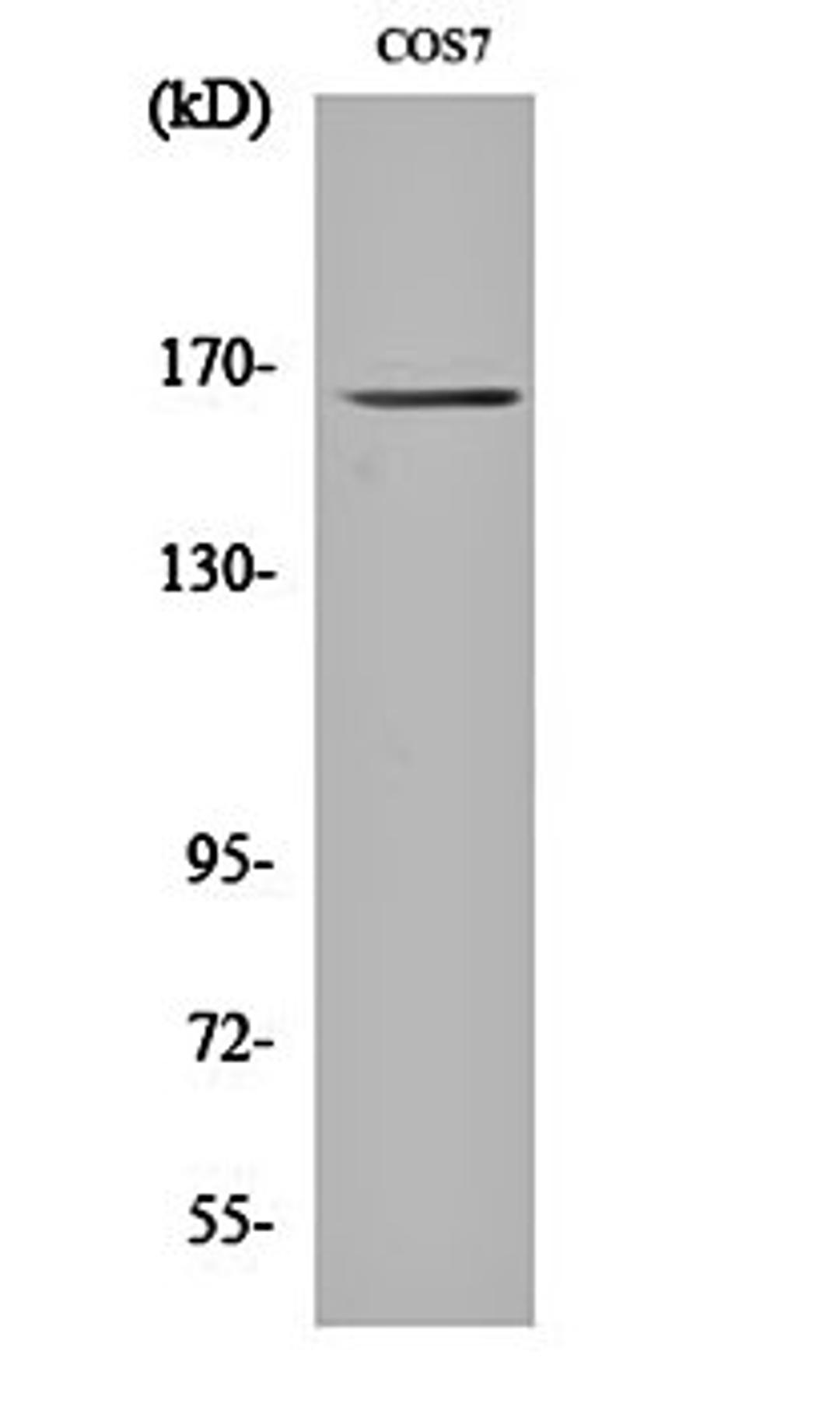 Western blot analysis of COS7 cell lysates using Myomesin-2 antibody