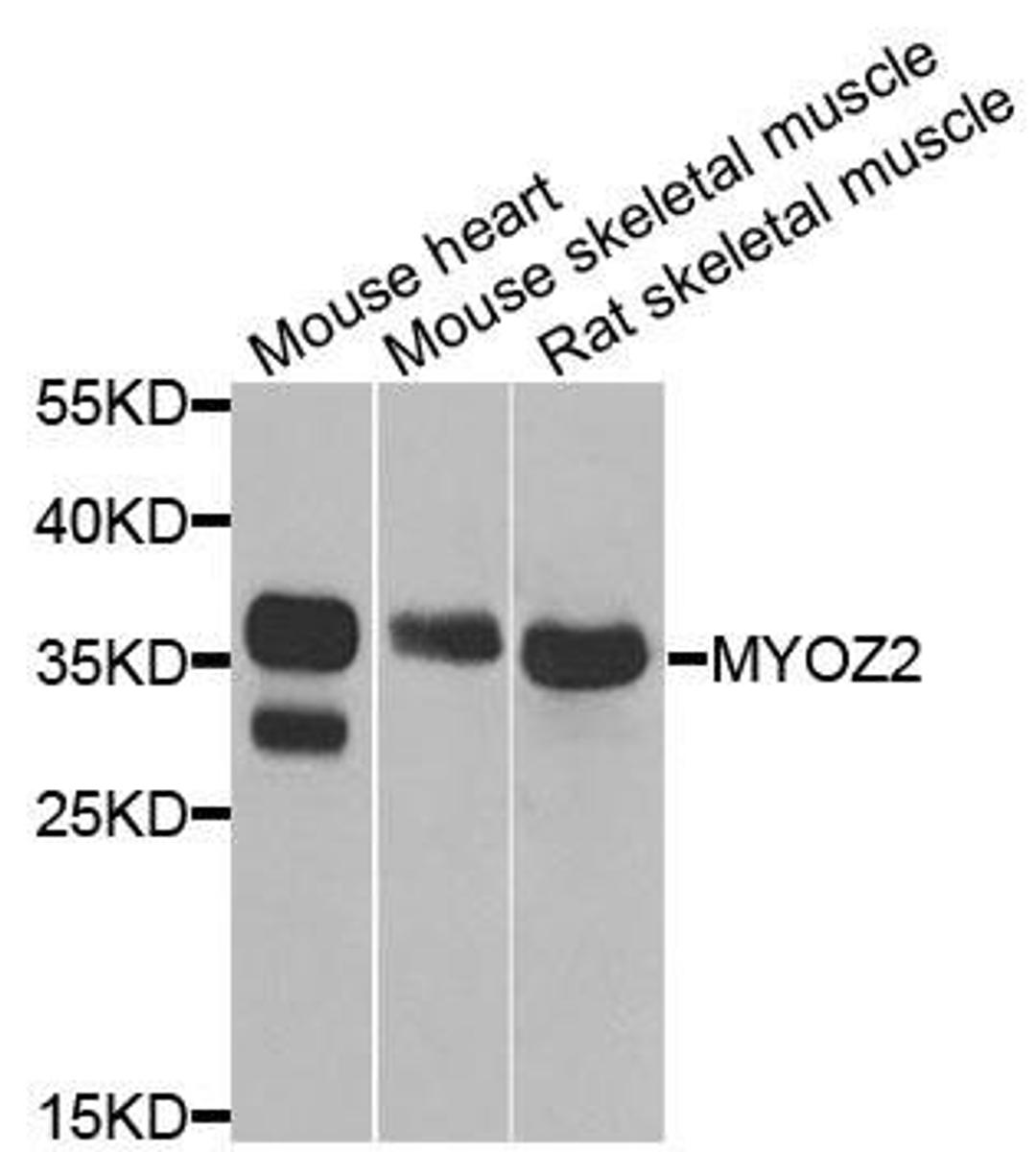 Western blot analysis of extracts of various cells using MYOZ2 antibody