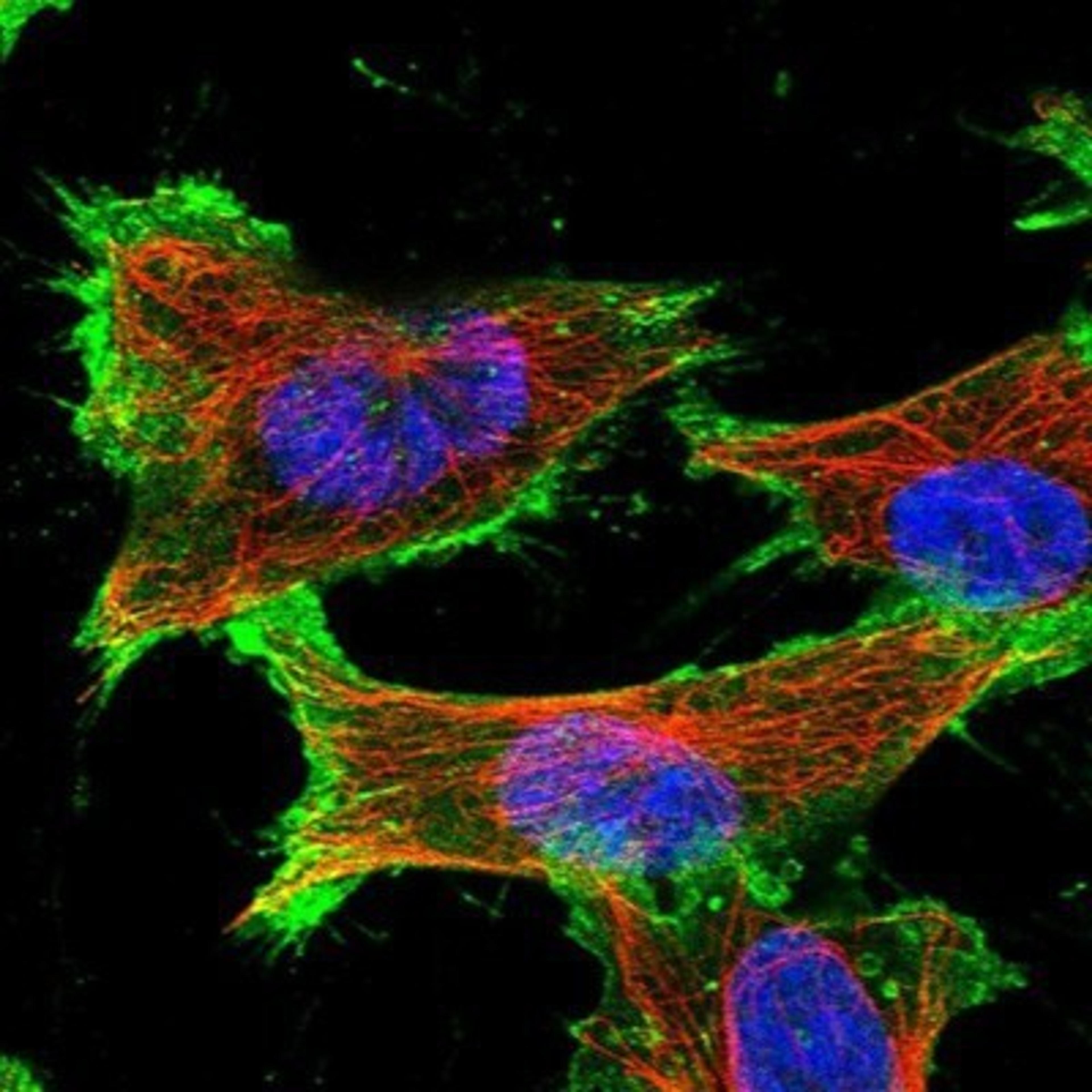 Immunocytochemistry/Immunofluorescence: SLC16A3 Antibody [NBP1-81251] - Staining of human cell line U-251MG shows positivity in plasma membrane.