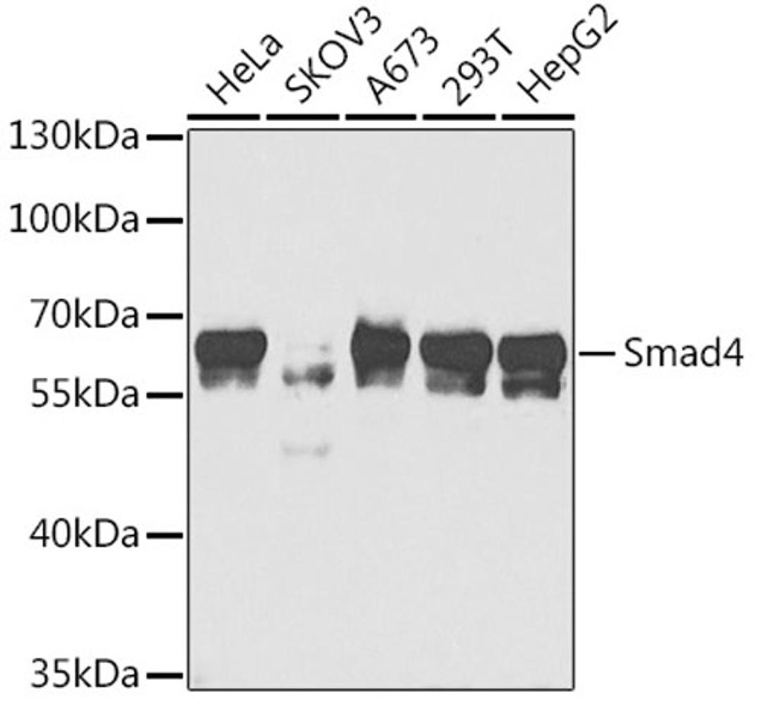 Western blot - Smad4 antibody (A5657)