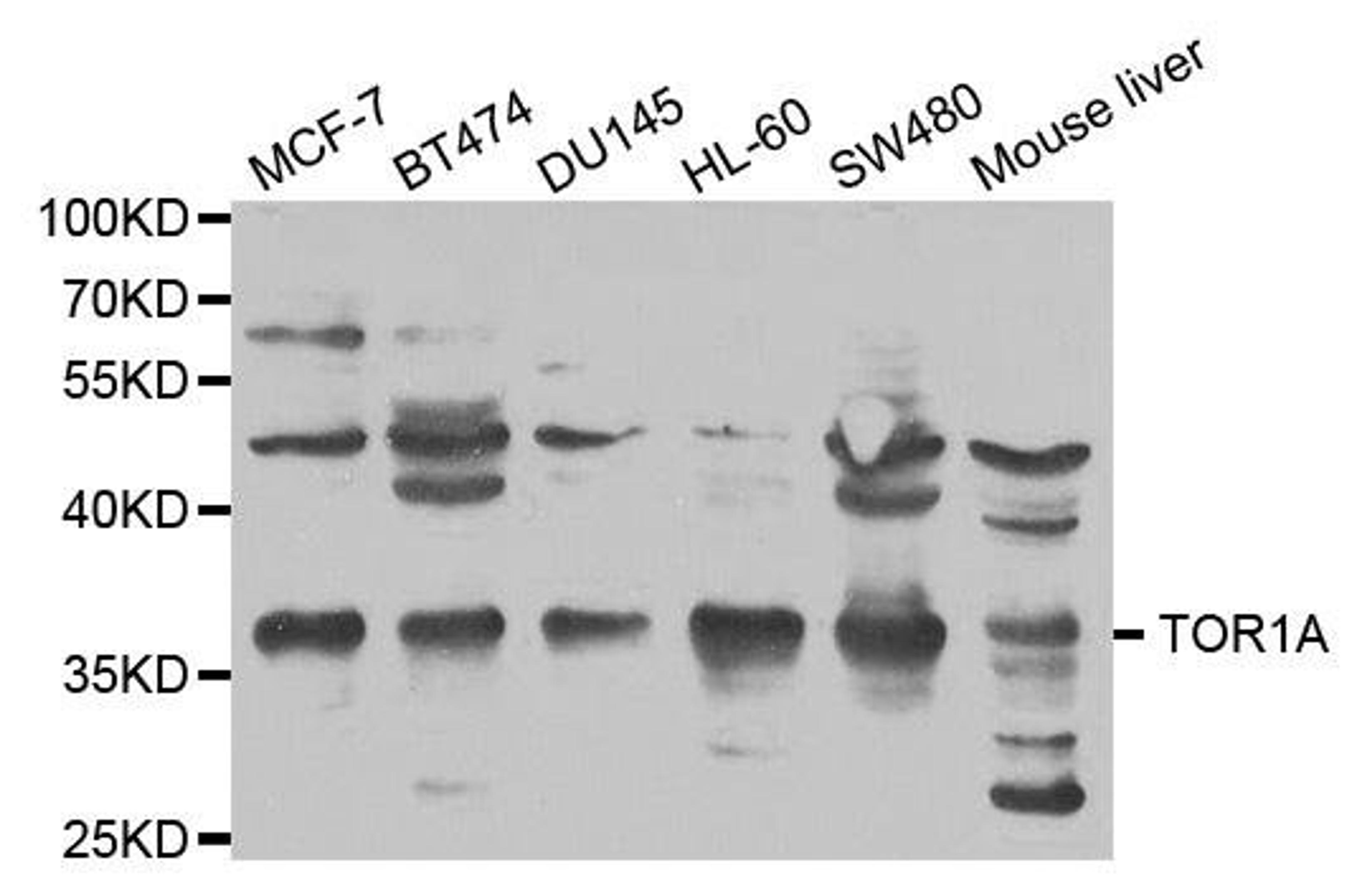 Western blot analysis of extracts of various cell lines using TOR1A antibody