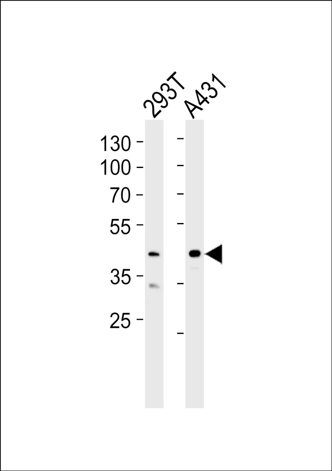 Western blot analysis of lysates from 293T, A431 cell line (from left to right), using CSNK2A1 Antibody at 1:1000 at each lane.