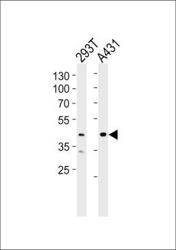 Western blot analysis of lysates from 293T, A431 cell line (from left to right), using CSNK2A1 Antibody at 1:1000 at each lane.