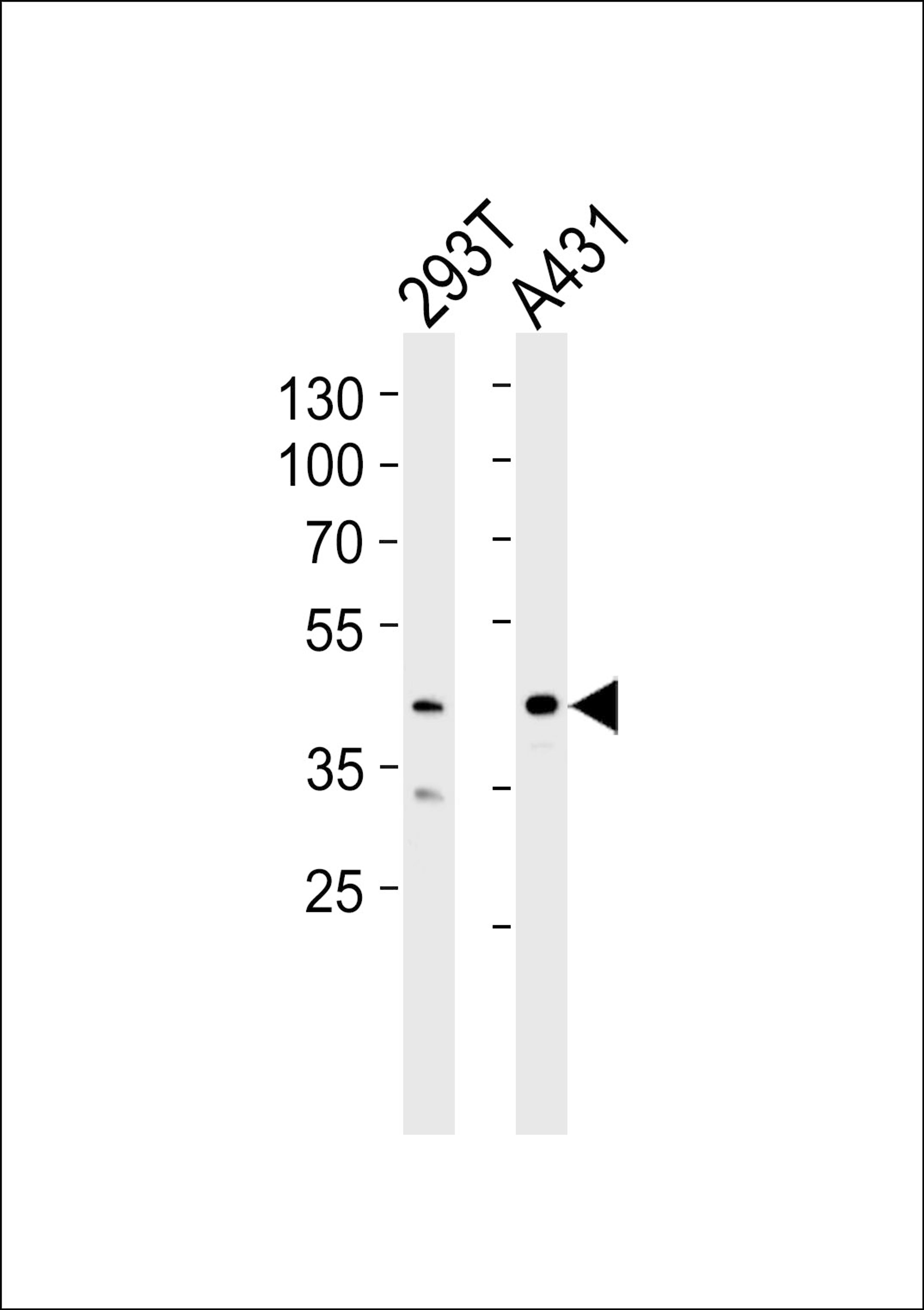 Western blot analysis of lysates from 293T, A431 cell line (from left to right), using CSNK2A1 Antibody at 1:1000 at each lane.