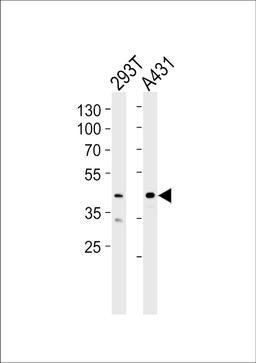 Western blot analysis of lysates from 293T, A431 cell line (from left to right), using CSNK2A1 Antibody at 1:1000 at each lane.