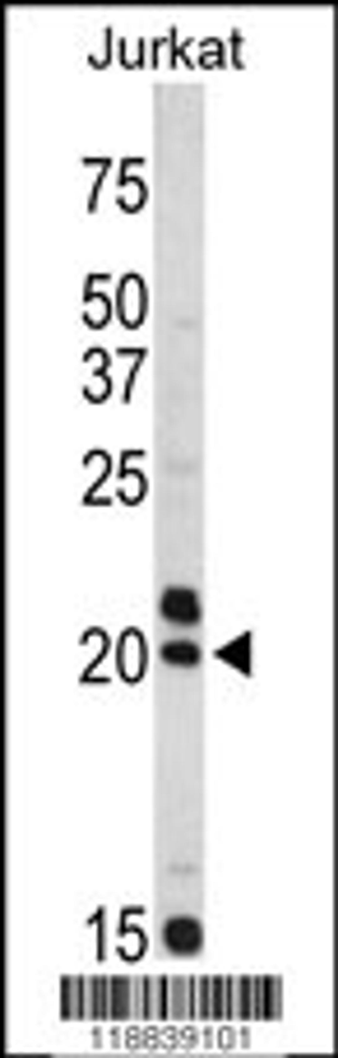 Western blot analysis of VIP antibody in Jurkat cell line lysates (35ug/lane)