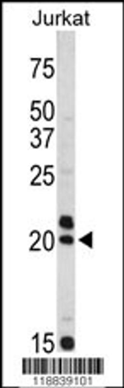 Western blot analysis of VIP antibody in Jurkat cell line lysates (35ug/lane)