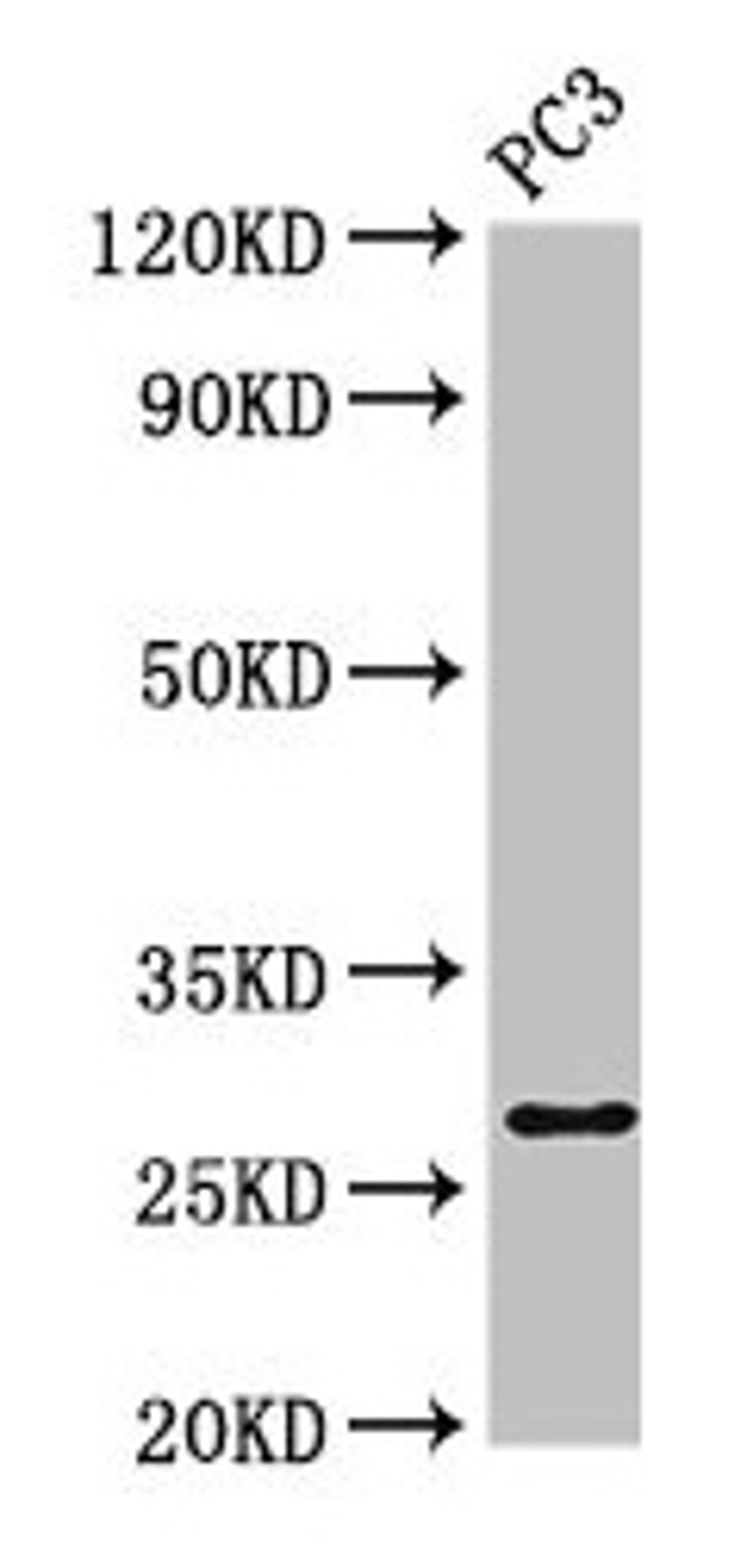 Western Blot. Positive WB detected in: PC-3 whole cell lysate. All lanes: IL34 antibody at 4µg/ml. Secondary. Goat polyclonal to rabbit IgG at 1/50000 dilution. Predicted band size: 28 kDa. Observed band size: 28 kDa