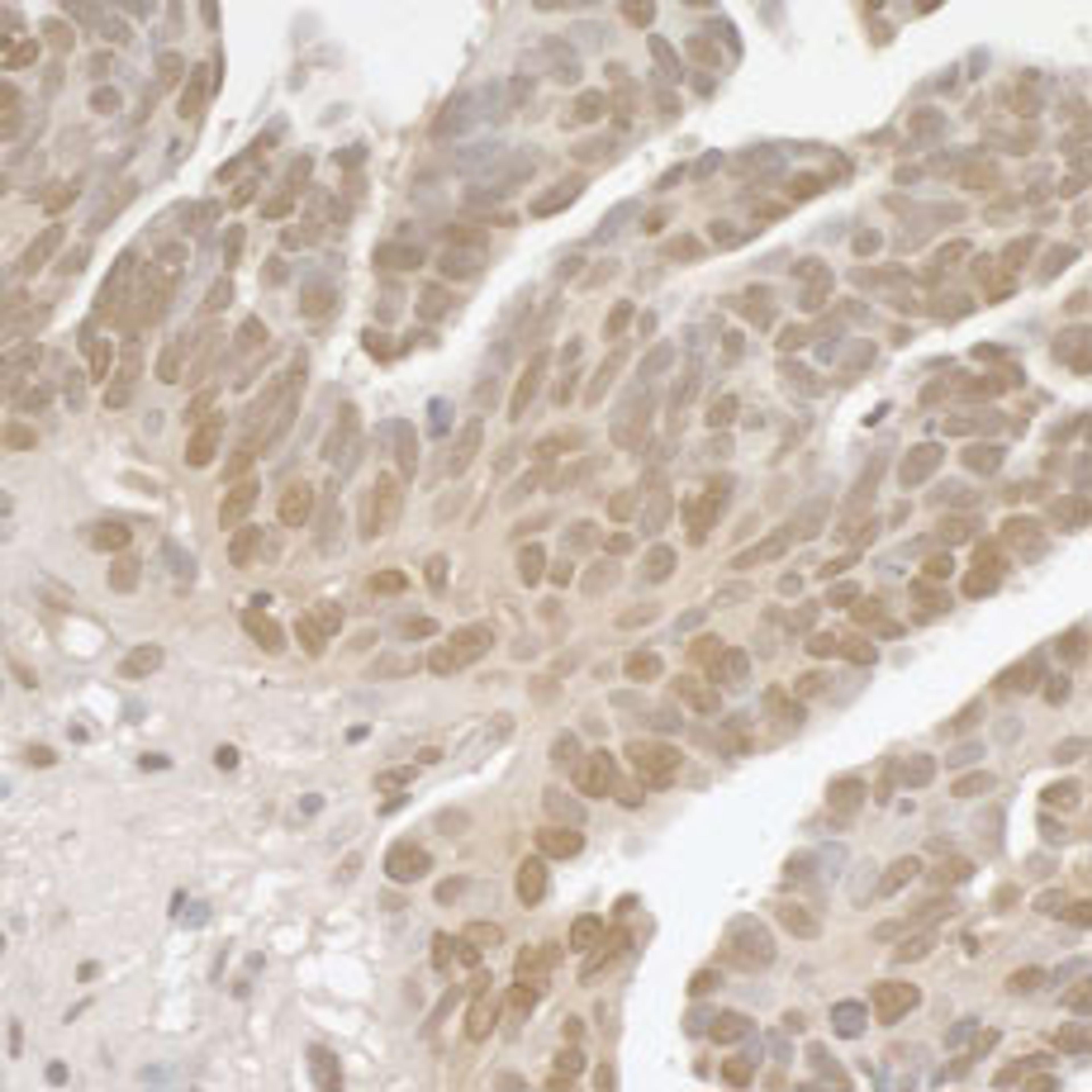 Detection of human SPF45 by immunohistochemistry.