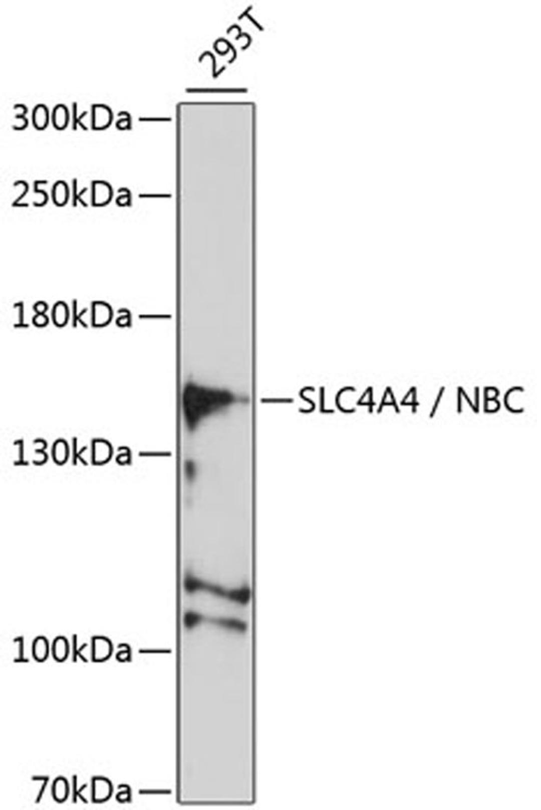 Western blot - SLC4A4 / NBC antibody (A5332)