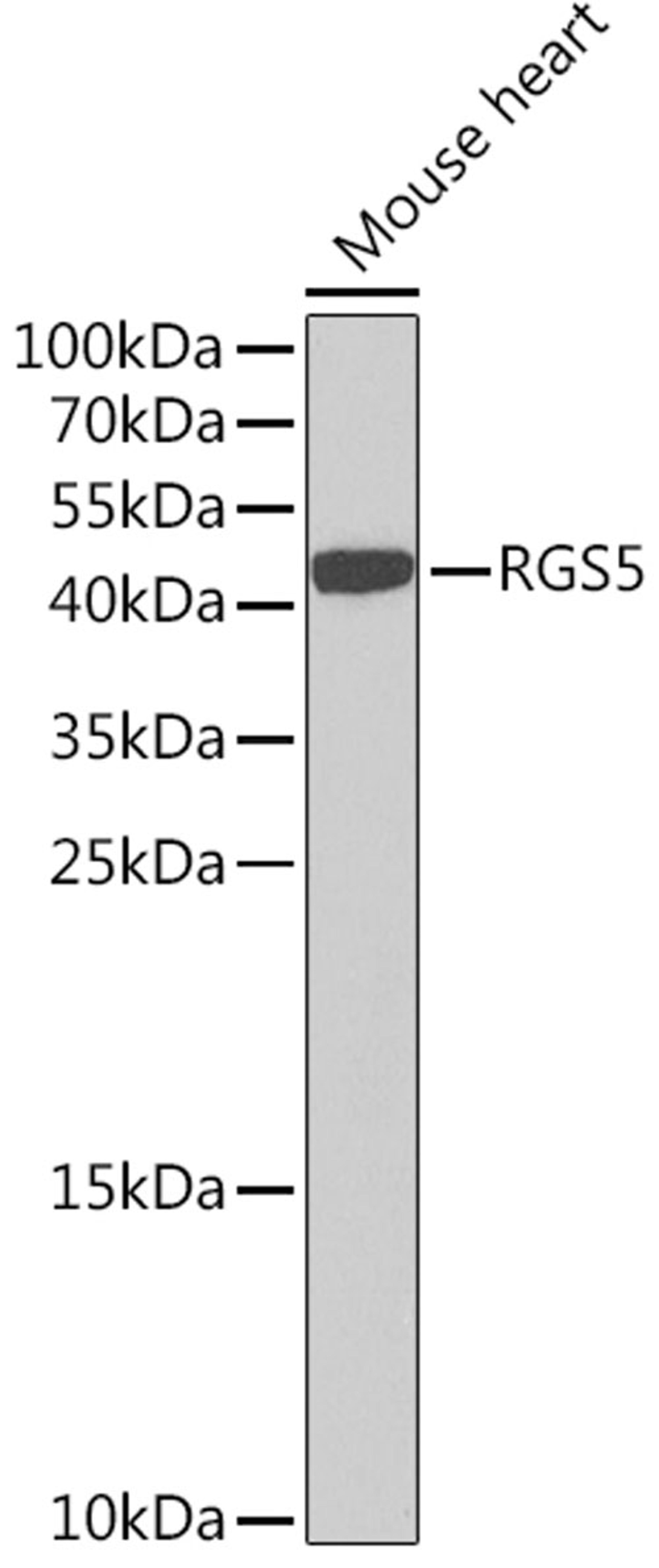 Western blot - RGS5 Rabbit pAb (A7015)