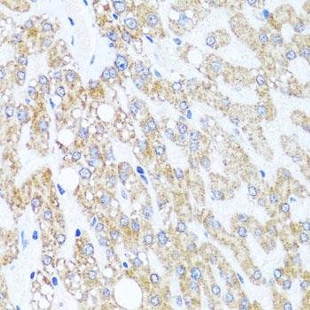 Immunohistochemical staining of mouse brain tissue using CHD1 antibody (dilution of 1:100)