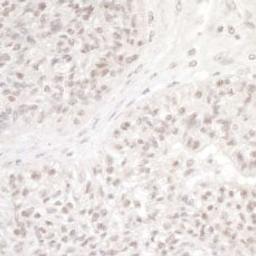 Detection of human DC8 by immunohistochemistry.